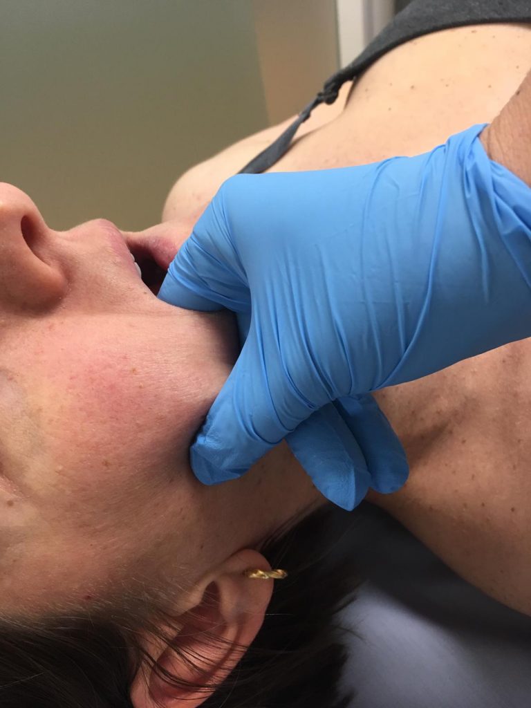 Tratamiento de la ATM Articulación Temporomandibular en REVIVE Fisioterapia